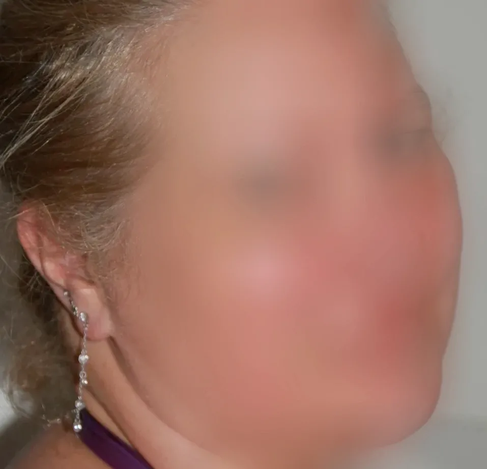 Esmee, 28